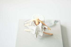 Orthopäde Berlin - Dr. Weischet und Dr. Marienfeld - Leistungen - Osteoporose